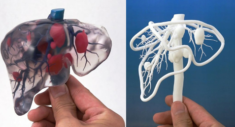 個(gè)性化醫(yī)療3D打印實(shí)戰(zhàn)案例與研究成果的問(wèn)答整理_3d打印服務(wù)公司