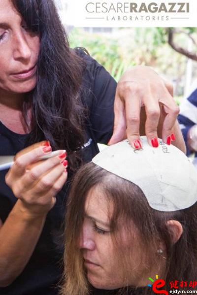 另類治療脫發的最好方法 用3D打印超逼真假發解決困擾 治療脫發不再煩,3d打印頭發,假發3d模型,3d打印材料,3d打印服務,3d打印廠家