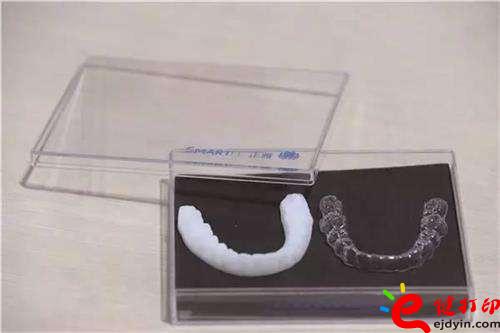 3D打印牙嵌體和牙套哪種更好？3D打印牙齒/隱形牙套/牙冠/模型/成品價格表