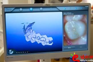 3d打印牙齒價(jià)格,3d打印牙齒模型,3d打印牙齒臨床了嗎,3d打印牙齒價(jià)格表,3d打印牙齒能用多久