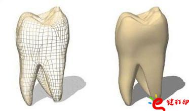 3d打印牙齒價(jià)格,3d打印牙齒模型,3d打印牙齒臨床了嗎,3d打印牙齒價(jià)格表,3d打印牙齒能用多久