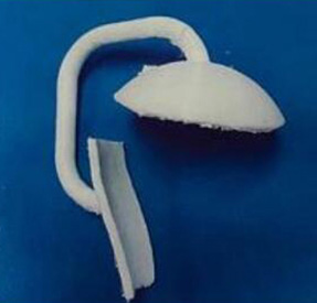 肩關(guān)節(jié)金屬植入物4